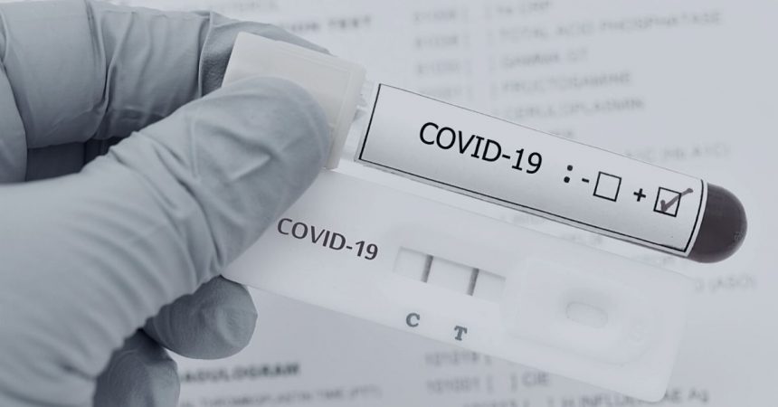 test diagnostico covid 19